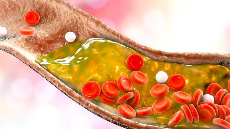 进口他汀和国产他汀有什么区别,进口他汀与国产他汀交换吃行吗