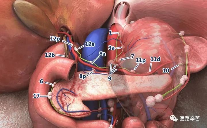 全腹腔镜胃癌根治术，学习大咖怎么清扫淋巴结