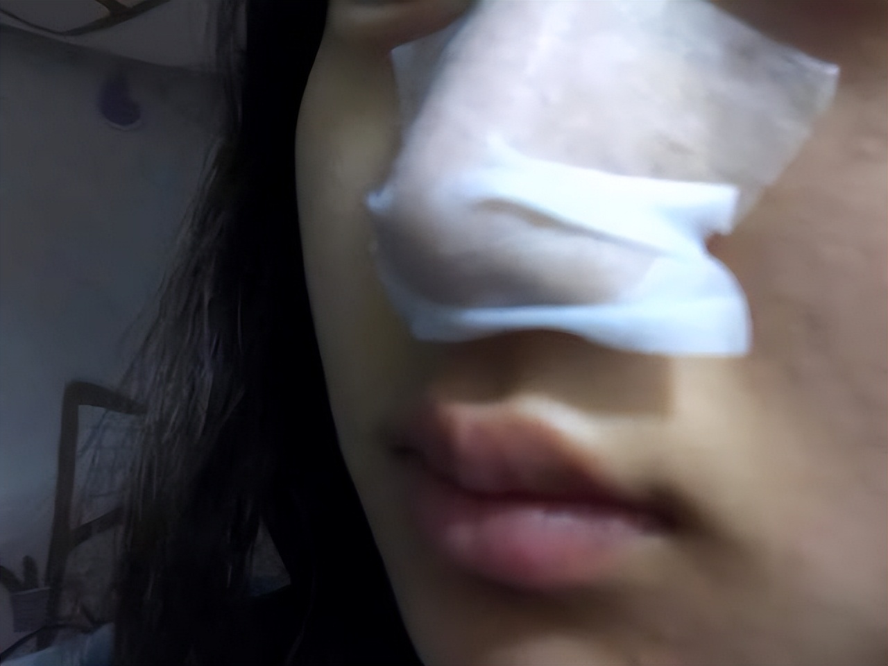 眉心鼻翼和下巴长粉刺为什么,鼻头上起粉刺什么原因引起的图片