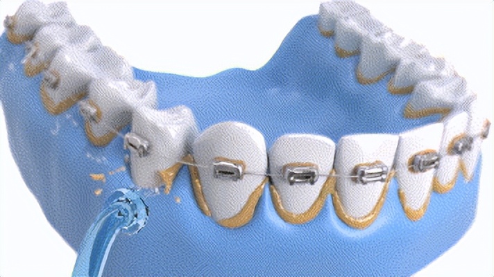 冲牙器测评实验室,冲牙器洁碧拜尔