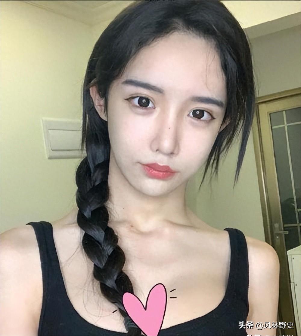 网红变性后遗症,网红变性36天痊愈