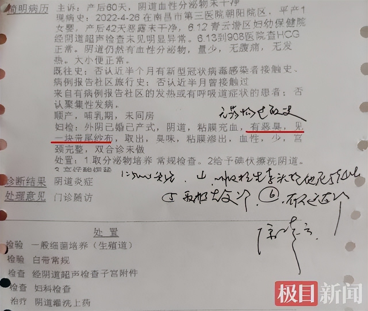 厦门顺产体内留纱布事件,南昌女子产后体内遗留纱布