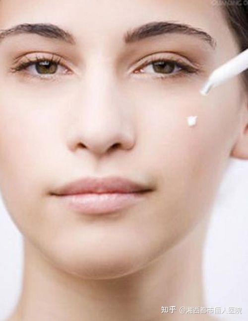 益阳专业祛除法令纹,霸州祛法令纹