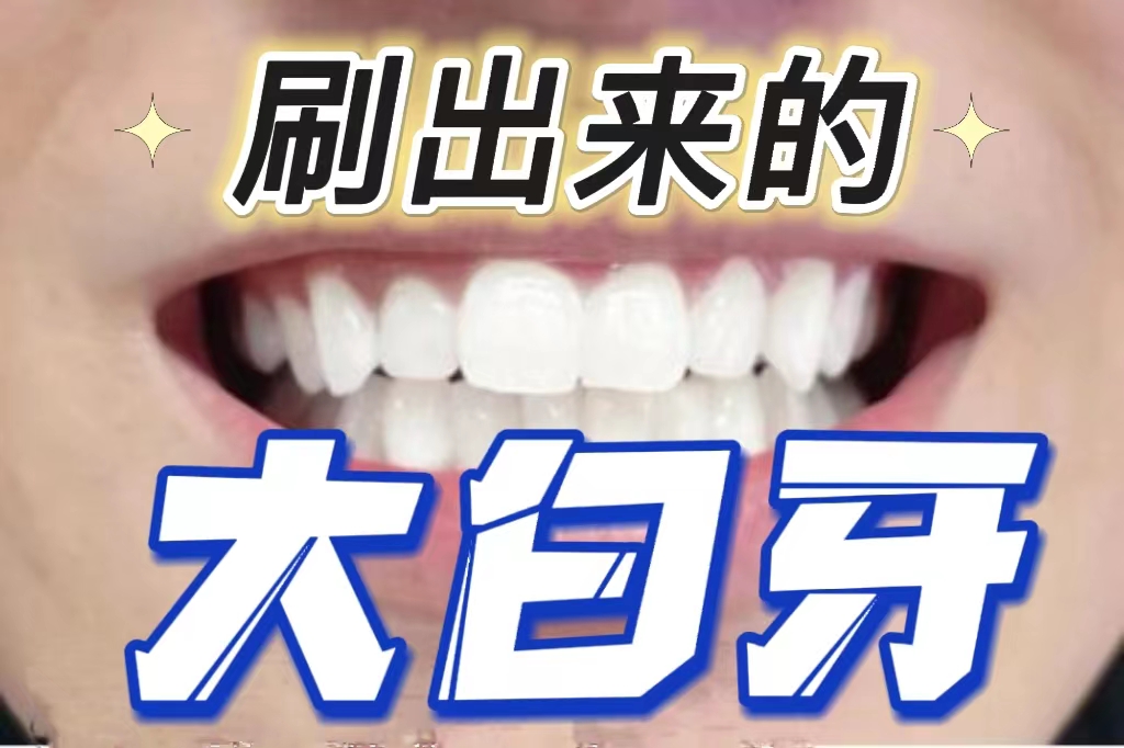 牙渍牙黄用什么牙膏刷牙,牙齿黑用什么刷牙可以让牙齿变白