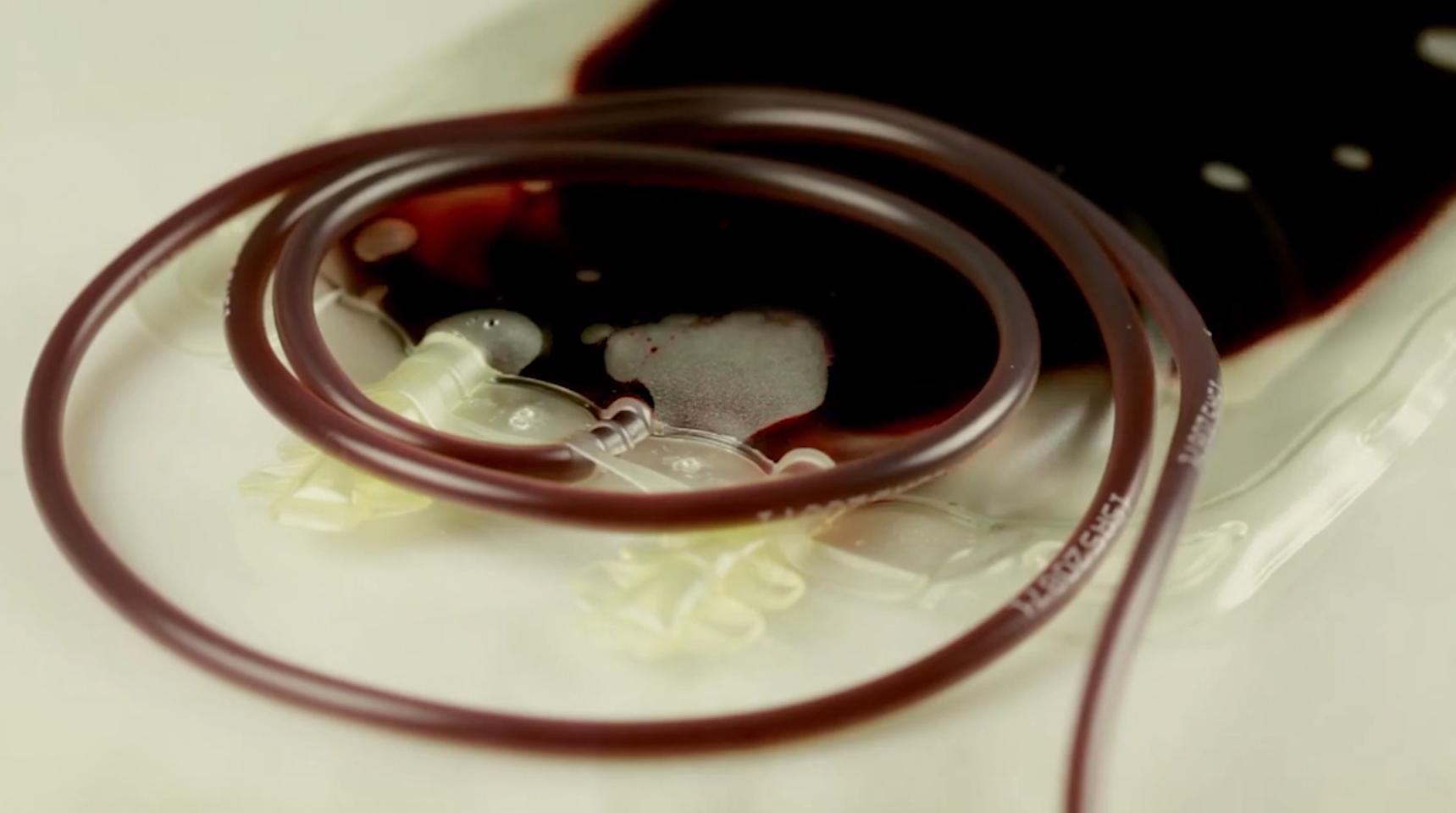 靠人血年赚3000亿，毒血散布全球，美国如何沦为*血卖**天堂？