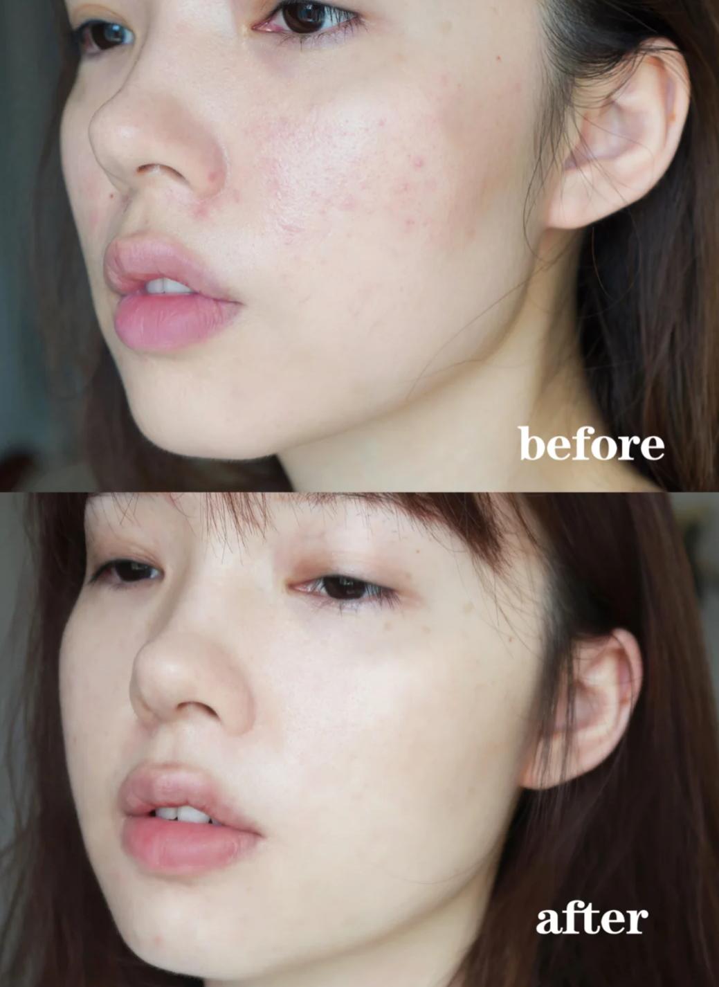 兰蔻菁纯眼精华秒杀,兰蔻菁纯臻颜玫瑰精萃水150ml价格