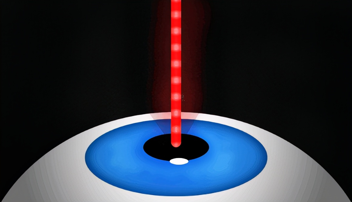 除了激光手术还有什么能矫正近视,近视植入晶体好还是激光矫正好
