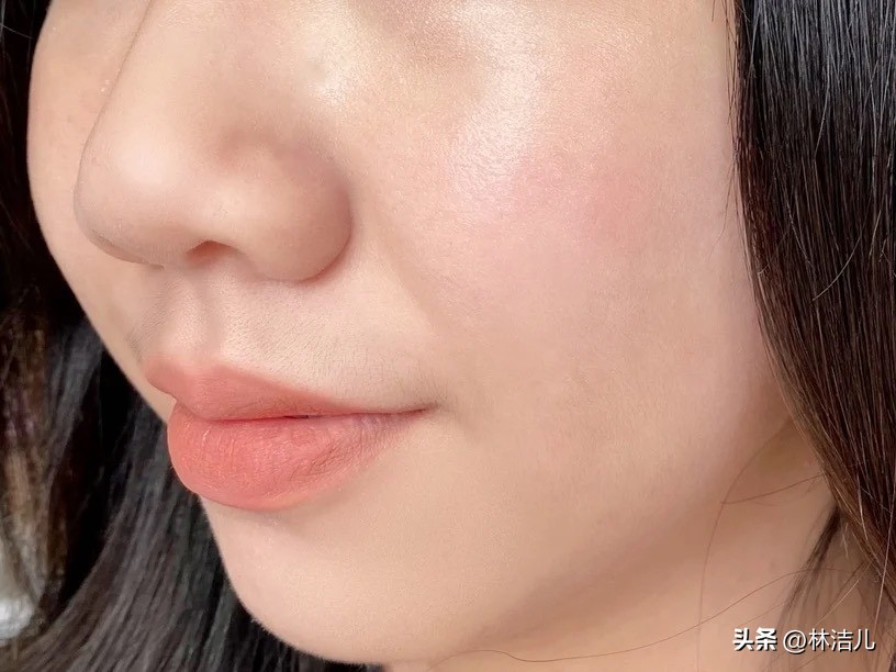 小棕瓶和小黑瓶祛痘,小棕瓶维稳抗老