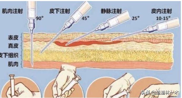 剧毒蝰蛇,毒性最强的蝰蛇