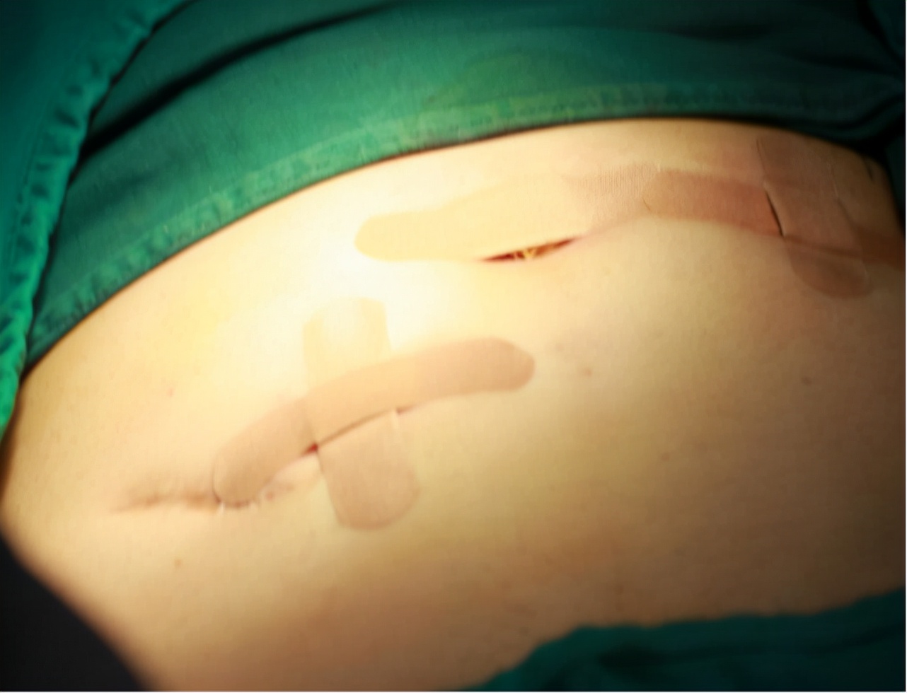 身体打洞手术,身体打孔能修复吗