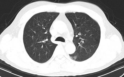 新冠抗原检测弱阳性核酸检测阴性,新冠病毒做核酸和抗原哪个更准确