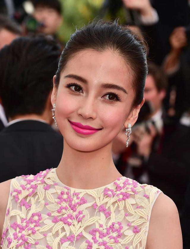 哪些明星整容后遗症越来越严重,整容明星后遗症对比图片