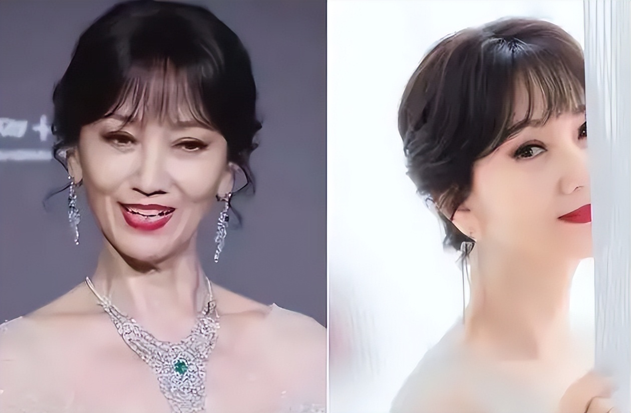 面部衰老皱纹解剖图,面部皱纹衰老对比图