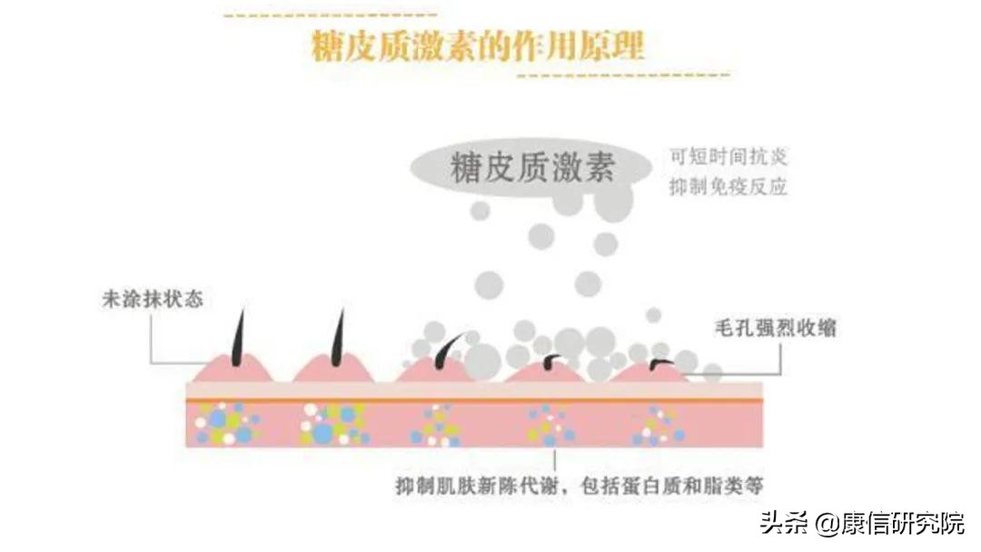 康信检测｜化妆品糖皮质激素检测的必要性