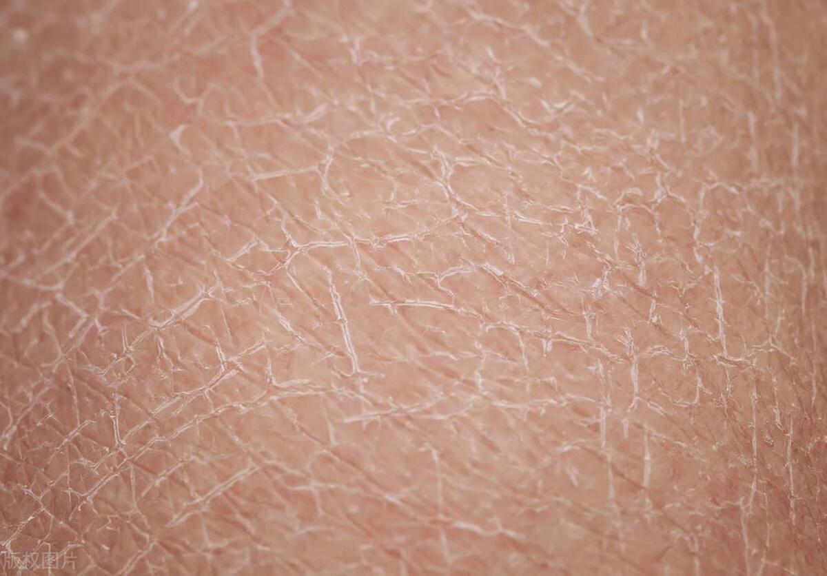 藿香正气水可治中暑,藿香正气水治中暑不