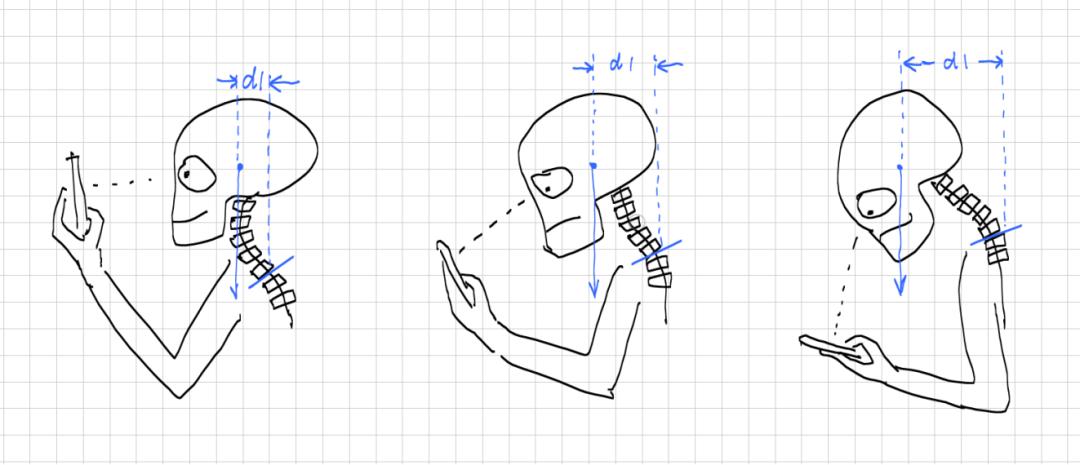 「诺总侦破日记」低头族颈椎失效模式的技术分析