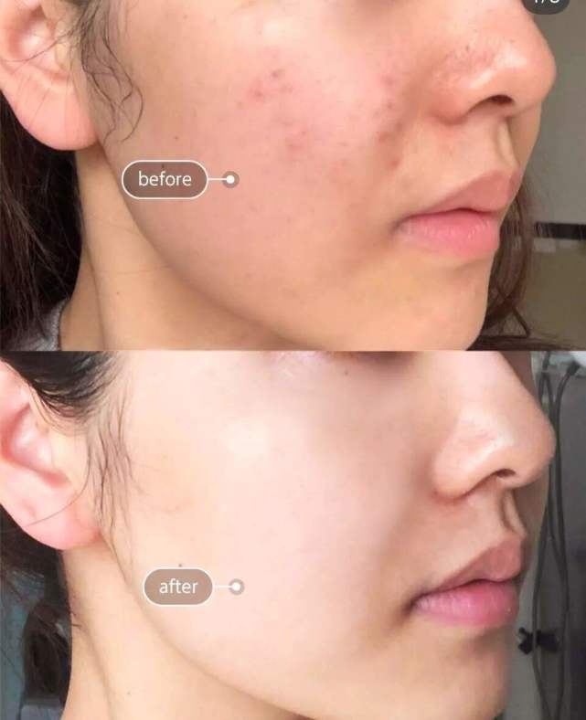 黄皮女生的护肤品,黄皮女生适合用什么护肤品