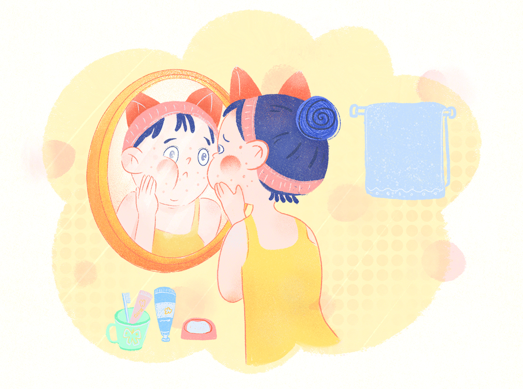 脸上长痘痘应该怎么治疗？现在告诉你方法，千万别乱挤