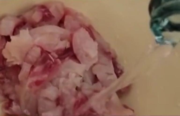 故事：湖北55岁男子病从口入，孕出成千上万虫卵，肚子竟成虫窝