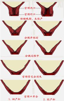 孕妈妈怎么判断胎位是正的,胎儿屁股在右侧是什么胎位