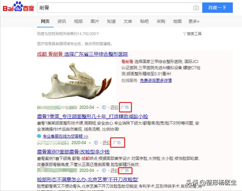 削骨后遗症最严重的后果,削骨失败案例后遗症