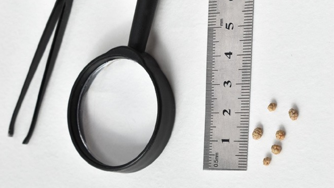 体检查出了肾结石怎么办,体检查出肾结石要不要治疗