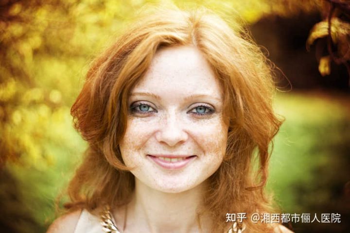 小女孩脸上长雀斑是什么原因,小女孩长雀斑怎么办