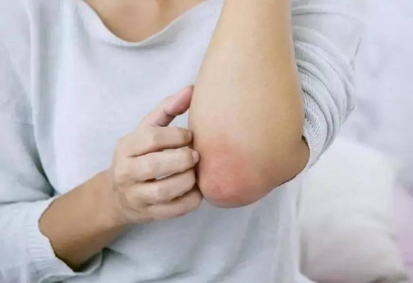 脖子和腋下的小肉粒是怎么回事,脖子和腋下的小肉粒能揪掉吗