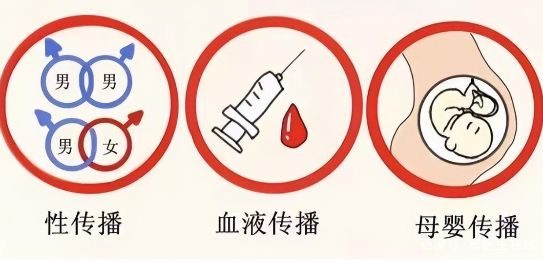 你以为的皮肤病却成了艾滋病，若出现这4种症状，说明病入膏肓了