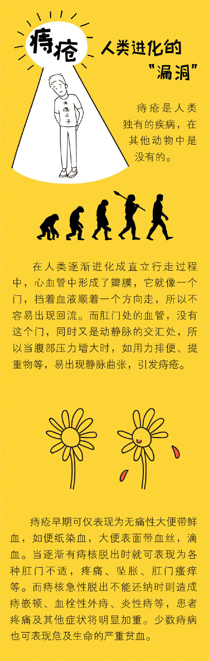 痔疮套扎手术的操作流程,痔疮手术后清洗流程
