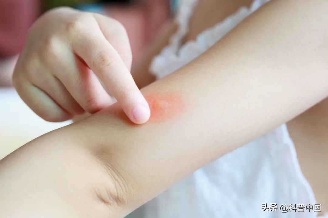 可以把蚊子催眠的歌,催眠蚊子纯音乐