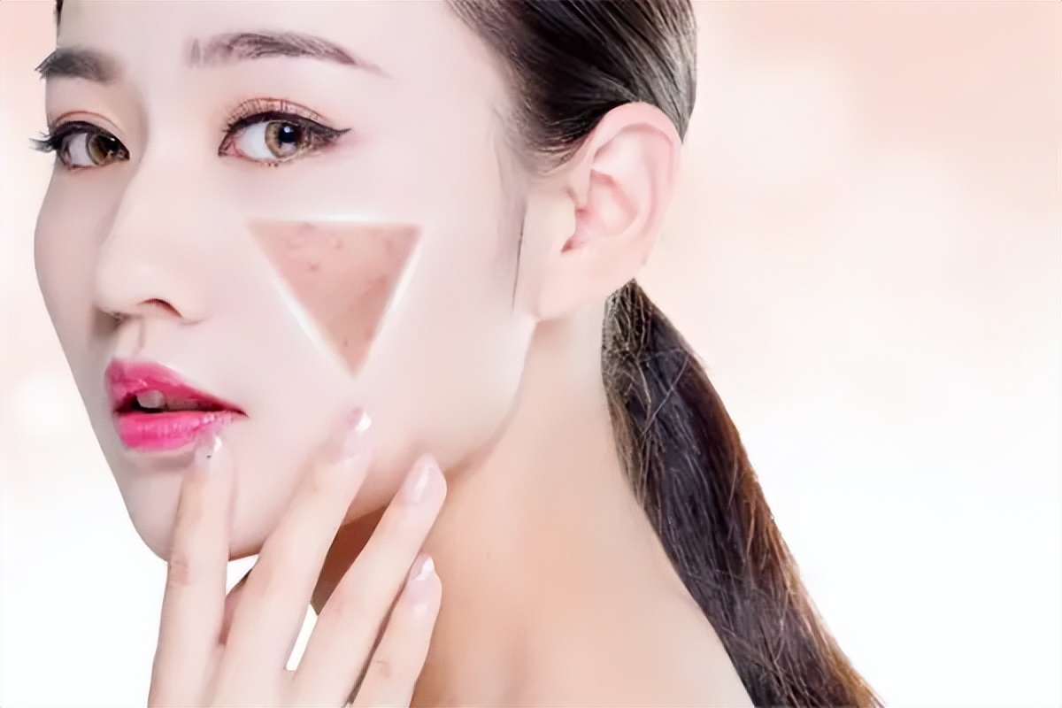 脸上各个部位长痘原因图片,脸腮部位长痘是什么原因