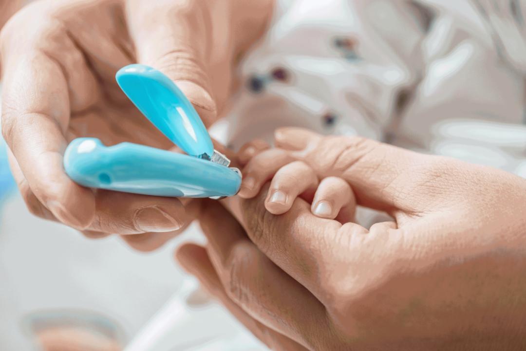 新生婴儿指甲长需要戴手套吗,新生宝宝指甲长要不要修一下