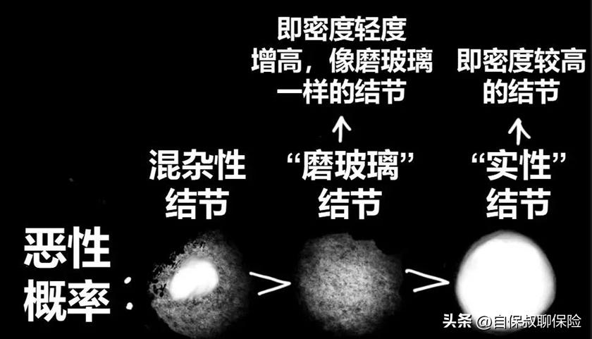 得了肺部结节还能买医疗保险吗,生病了再买保险来得及吗