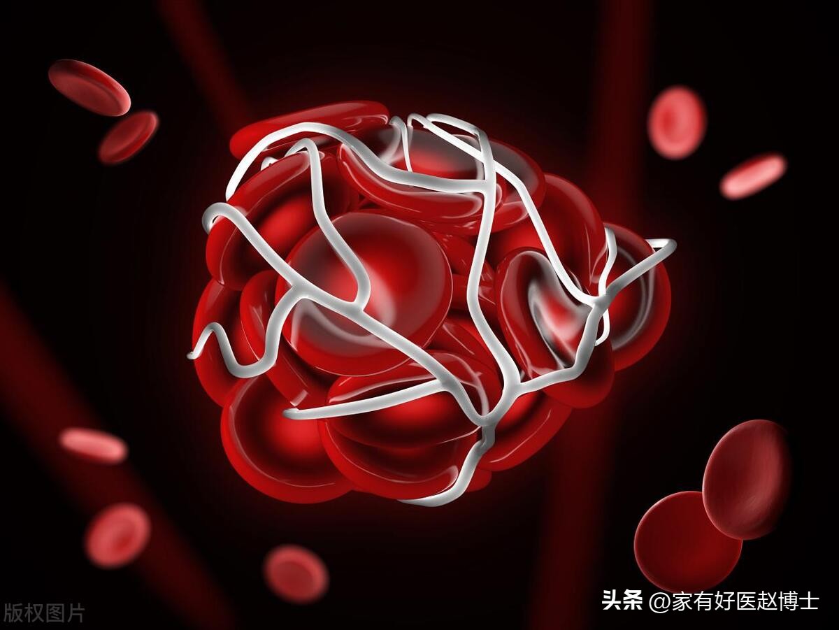 有过一次房颤就必须吃抗凝药吗,偶尔一次房颤可以治愈吗