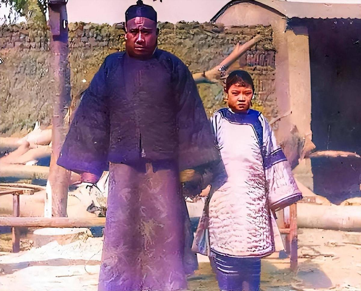 罕见照片，世界上胸最大的女人，女人舌头10.16厘米，你见过吗