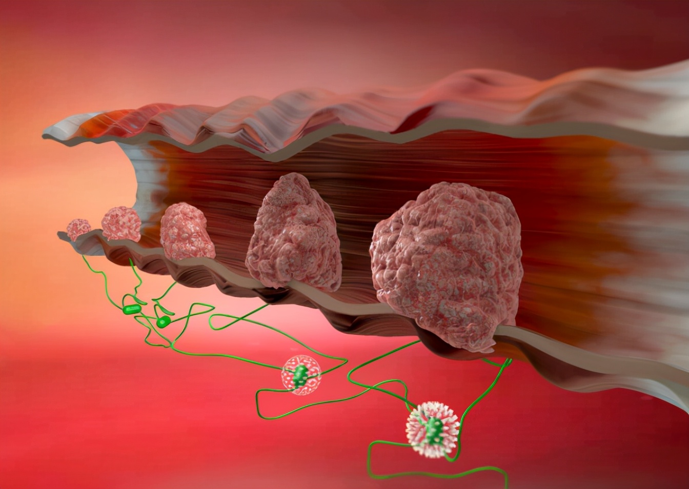 女性肛周瘙痒是癌吗,肛周瘙痒是直肠癌吗
