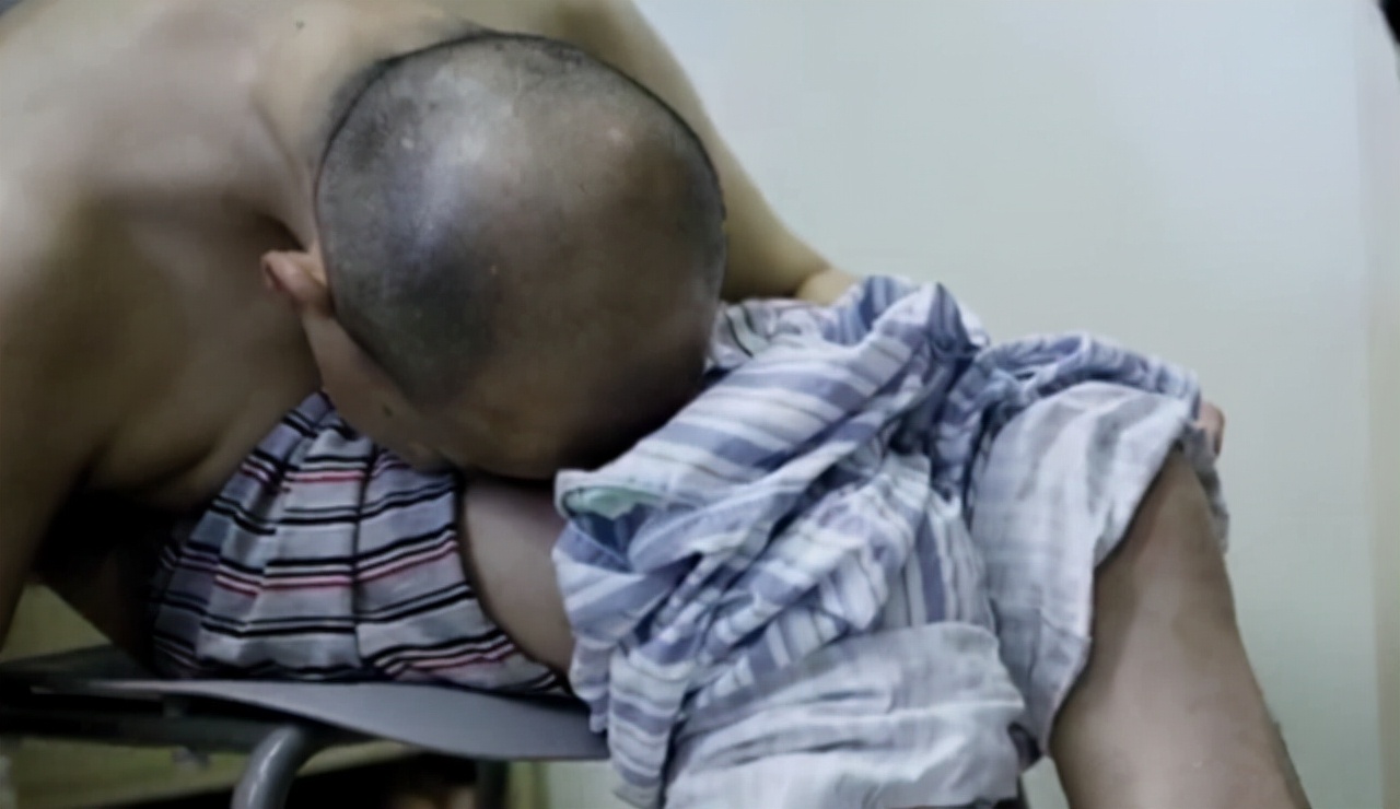 折叠人李华后续,折叠人李华四次手术完整版