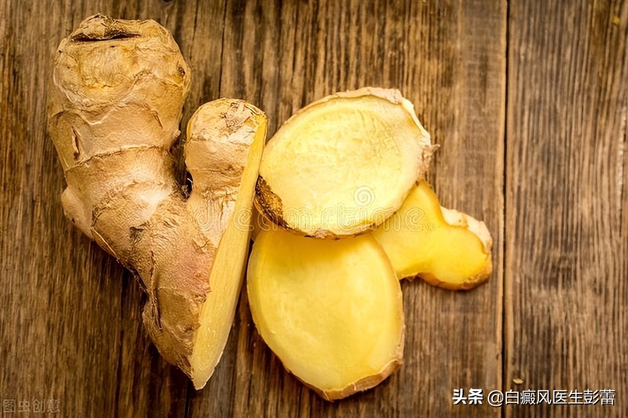 白癜风生姜治疗方法,科普白癜风生姜擦拭白斑有用吗