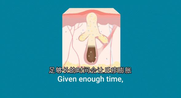 医圣张仲景发明的活血化瘀第一方,张仲景治疗结节囊肿的方子