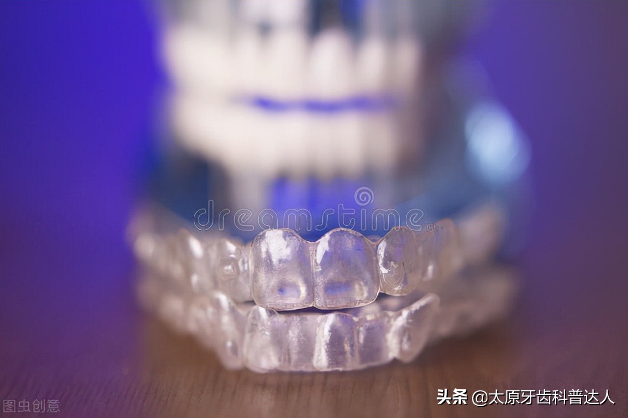 牙齿矫正后保持器需要定做吗,矫正牙齿保持器是什么