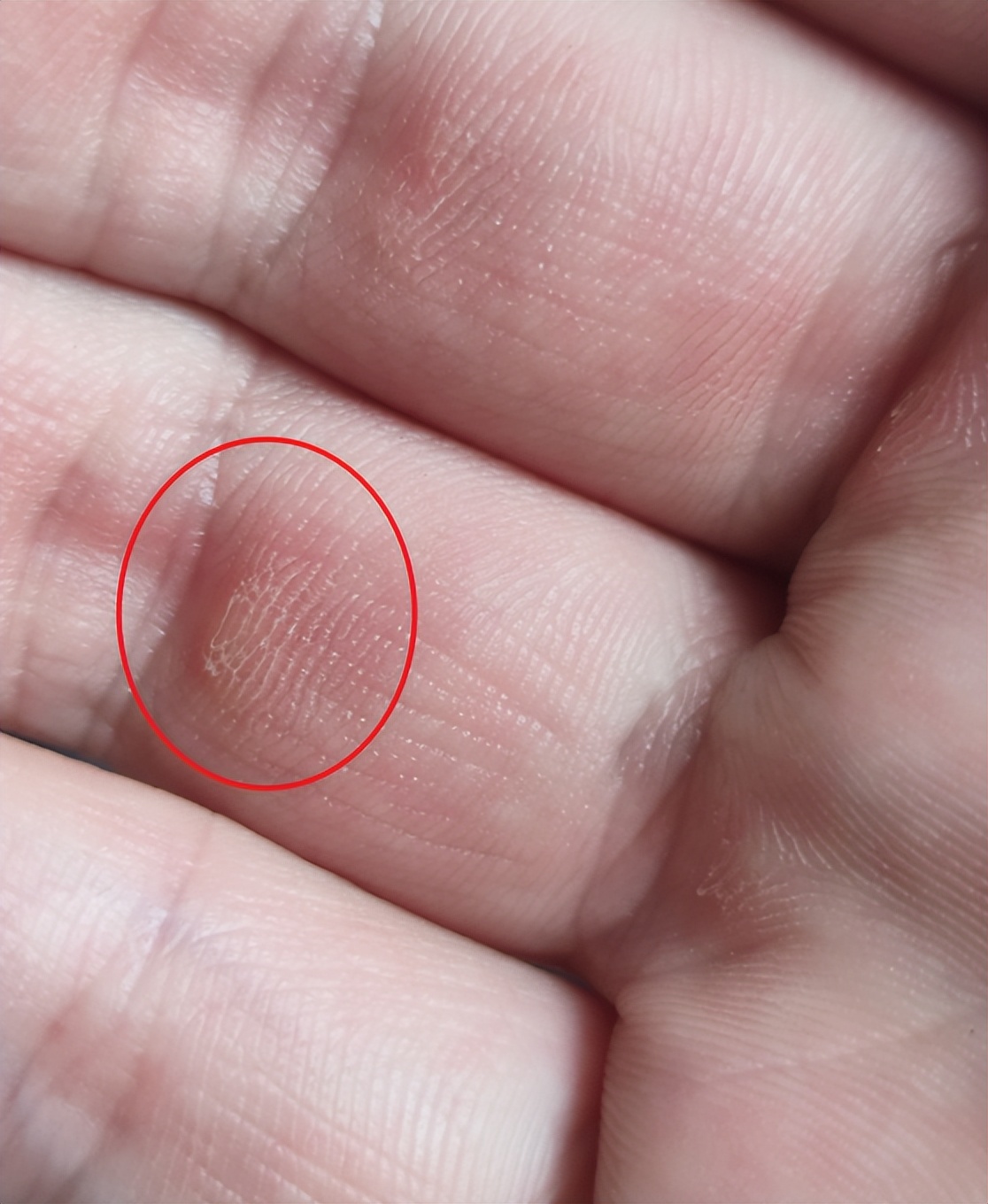 怎样使用划船机不伤膝盖,划船机如何不用腰发力