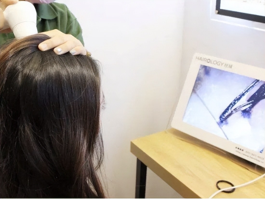 头皮里老是长疙瘩和脓包,头皮上长红疙瘩脓包头皮屑特别多