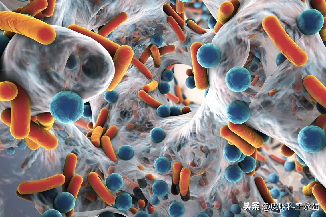 疥螨是怎样引起的,疥螨引起的症状