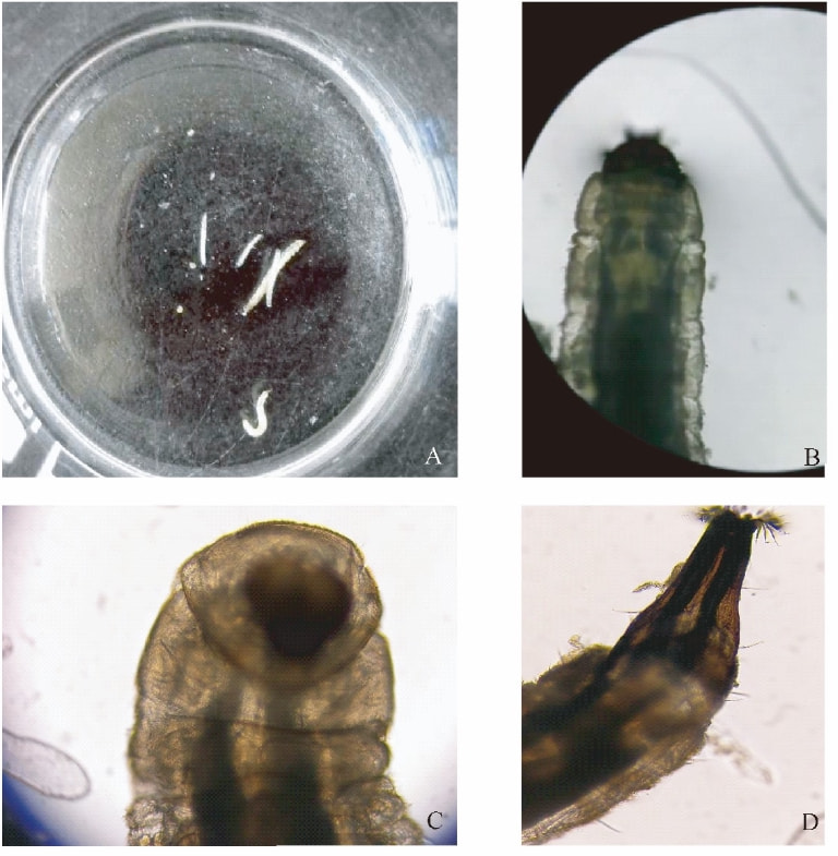 卫生间小飞虫的危害,卫生间小飞虫如何彻底解决