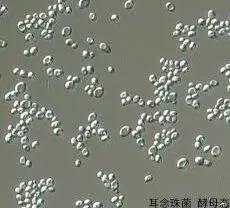 耳念珠菌与普通白色念珠菌有哪些不同？