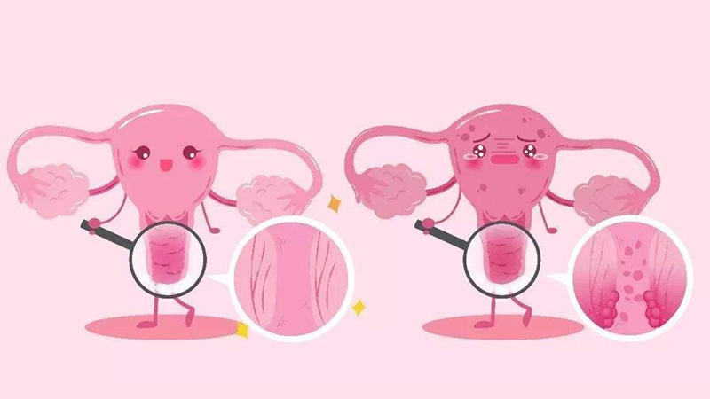 使用润滑剂，对夫妻双方有害吗？科学使用润滑剂，3点要记好