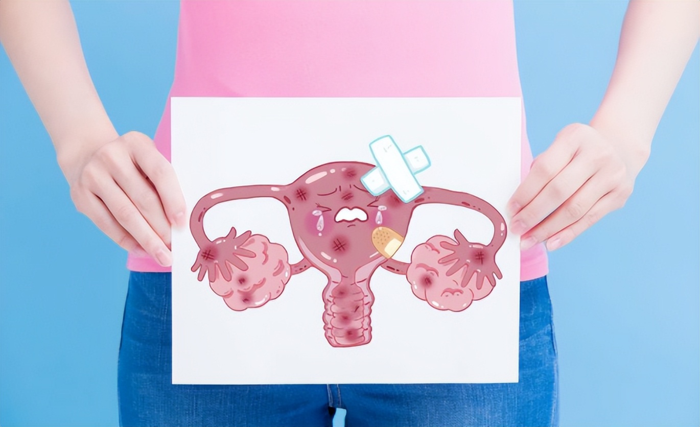 68岁老太，子宫从下面“掉”了出来？如何预防和应对子宫脱垂？