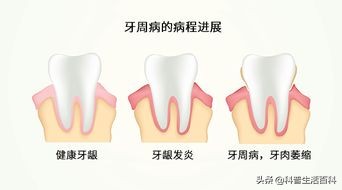 如何正确的刷牙,如何才能正确刷牙