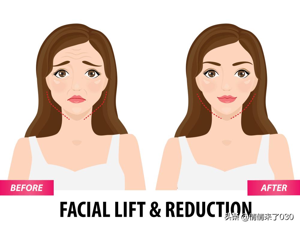 脸上皮肤松弛怎么紧致男生,脸上的皮肤松弛下垂怎么办